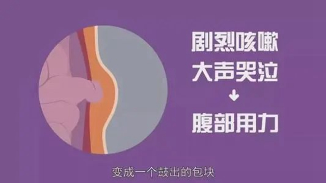 【擴(kuò)散】孩子哭鬧后大腿根鼓個(gè)包？居然是……(圖4)