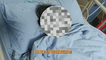 傷口又小恢復(fù)又快，膽管結(jié)石“殺手”來(lái)了！(圖1)