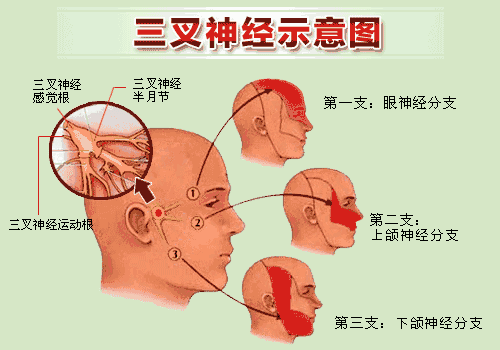 【視頻】三叉神經(jīng)痛痛痛痛痛不停，該如何拯救？趕緊戳進(jìn)來(lái)看！(圖2)