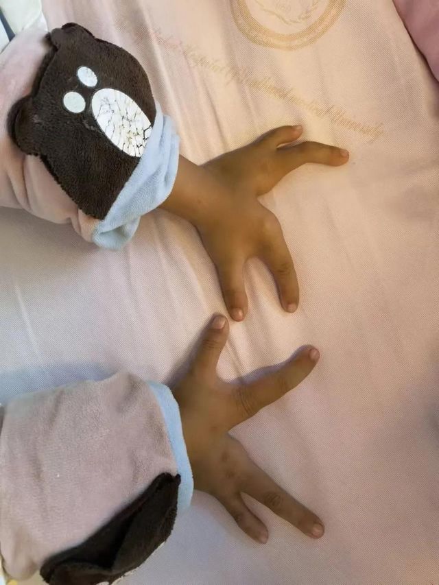 孩子分開的手指終于合上了，父親笑了！(圖2)