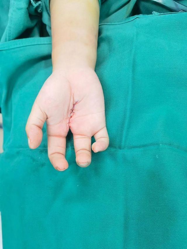 孩子分開的手指終于合上了，父親笑了！(圖7)