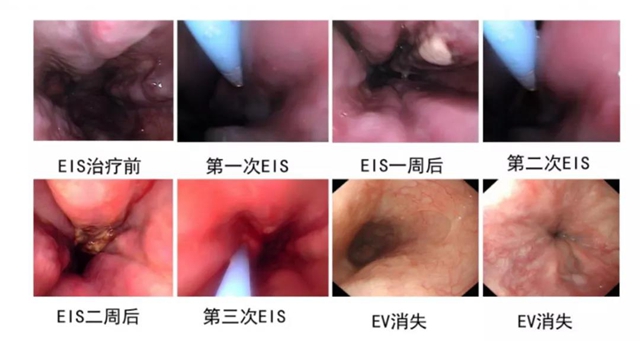 【注意】脾胃·風濕免疫病科有新家了！(圖10)