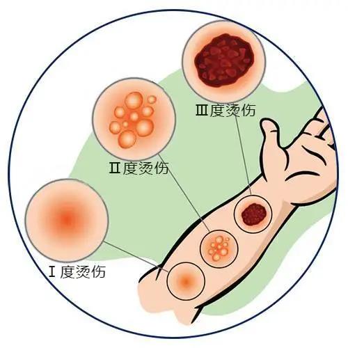 【突發(fā)】燃油起火！瀘州男子多處被燒傷！(圖6)